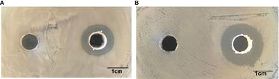 Effects of dietary Bacillus amyloliquefaciens on the growth, immune responses, intestinal microbiota composition and disease resistance of yellow catfish, Pelteobagrus fulvidraco